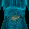 ​What are the classic symptoms of pancreatic cancer?​