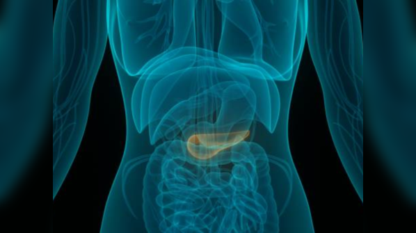What are the classic symptoms of pancreatic cancer?