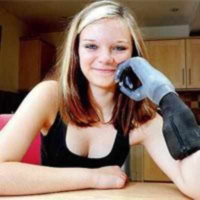Teen among youngest to get bionic fingers