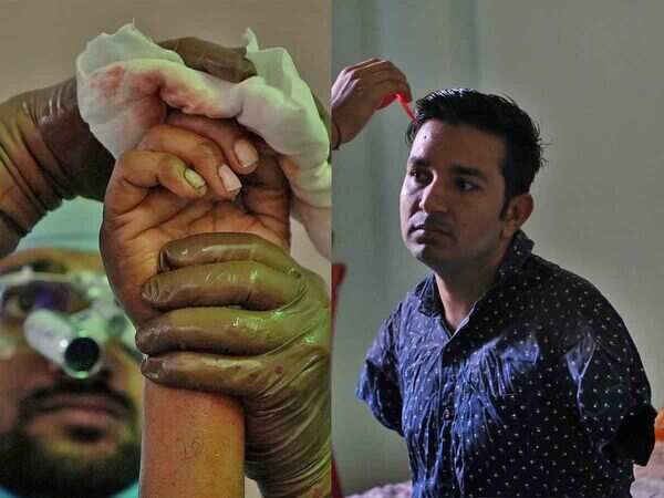How Prema Ram got a full arm transplant, a first in Asia, after 15 years of struggle