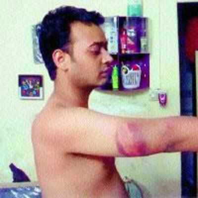 Arrested for attacking constables, city youths allege assault by Turbhe cops