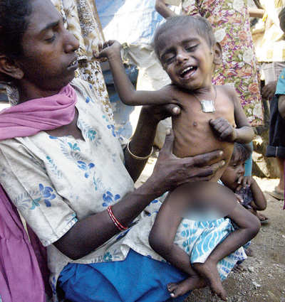 Kids severely malnourished but govt looks the other way