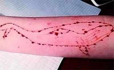 Blue Whale incident: 25 students from Karnataka’s Belagavi rescued; wounds found on their arms