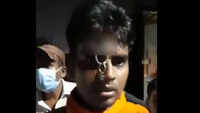Uttarakhand: Man stabbed by cops on forehead with his bike key for not wearing helmet 