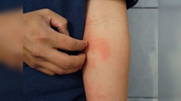Skin problems