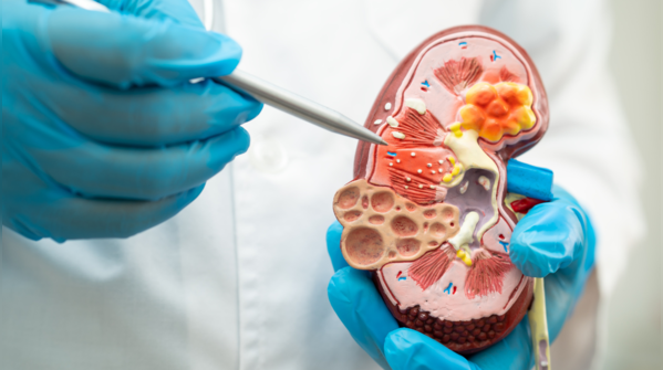 Nourish your kidneys for optimal health