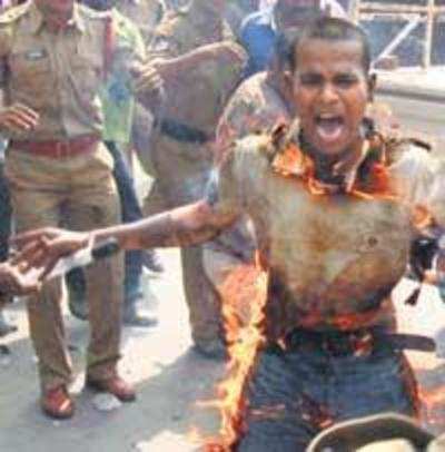 Telangana youth succumbs to burns