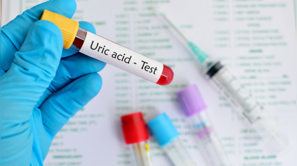 ​How do you reduce uric acid levels?