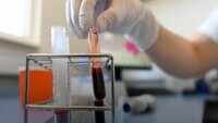 What does Plasma Therapy mean for you? 