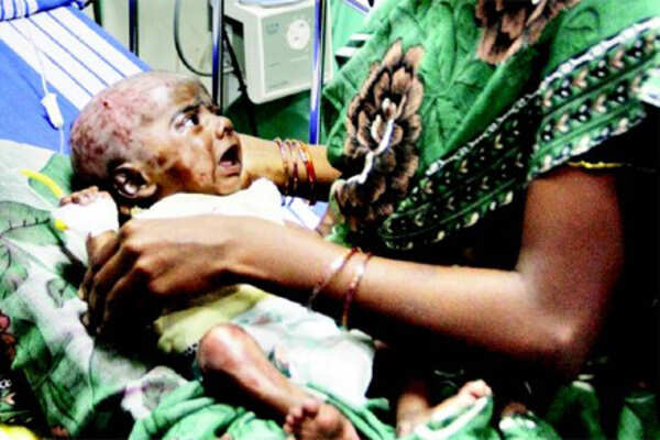 The baby who caught fire by itself