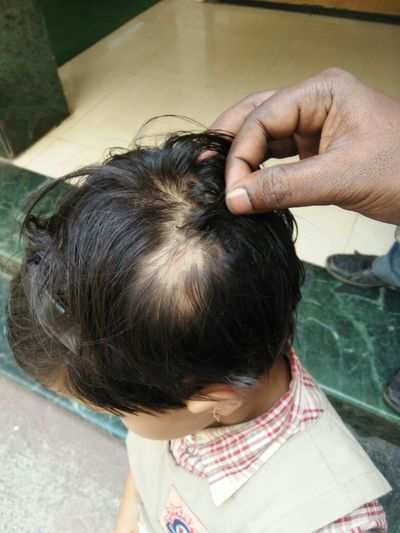 Six-year-old Thane girl allegedly beaten up by teacher