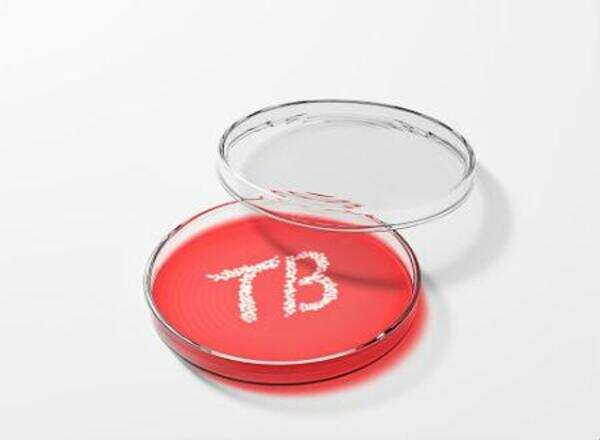 Regime to track TB patient's medication through cellphones
