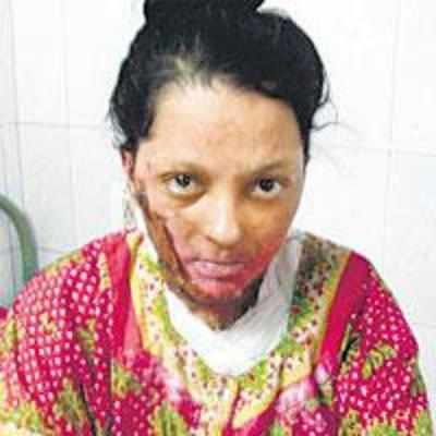 Dowry fire chokes yet another woman