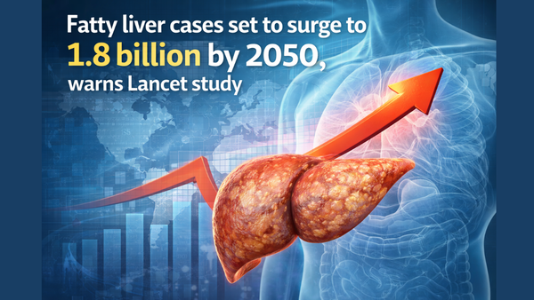 Fatty liver cases set to surge to 1.8 billion by 2050, warns Lancet study