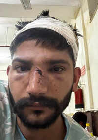 Man, brother attacked with hammer and rods over court testimony, FIR against 8