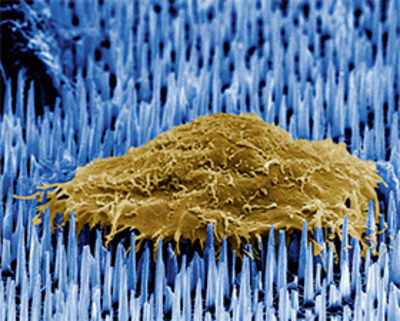Nanoneedles may help the body repair itself