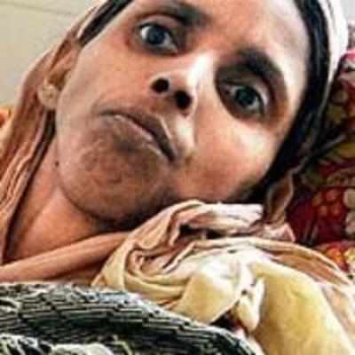 Mumbai woman with locked limbs sleeps on bed after 14 yrs
