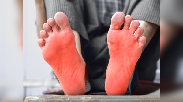 Burning feet at night