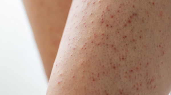 Are they just skin spots?