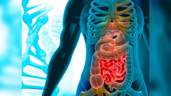 Bowel cancer: When you should stop confusing it with 'hemorrhoids ...