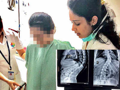 14-yr-old’s spine deformity corrected by city doctors