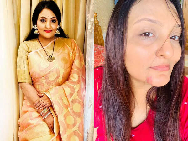 Urvashi Upadhyay gets injured on the set of Rang Jaun Tere Rang Mein