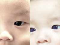 ​Baby's eye color changed!​