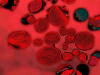 ​High blood sugar can damage <i class="tbold">blood vessel</i>s