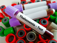​India has the <i class="tbold">largest number</i> of children with Thalassemia major in the world (2016 report)​