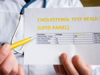 ​A total cholesterol level of more than 200 mg/dL is considered to be high​