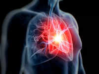 ​Lifestyle changes to prevent <i class="tbold">cardiac arrest</i>