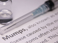 ​Preventive tips for mumps​