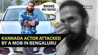 Shocking encounter: <i class="tbold">kannada actor</i> Chetan Chandra assaulted by a mob in Bengaluru; shares harrowing experience on social media