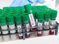 London's <i class="tbold">imperial college</i> to develop a low-cost Coronavirus vaccine