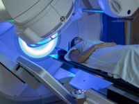 Myth: <i class="tbold">radiotherapy</i> burns the body or kills the patient