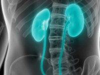 ​Myth: <i class="tbold">kidney cancer</i> surgery leads to removal of the kidneys​