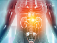 ​Myth: <i class="tbold">kidney cancer</i> is rare​