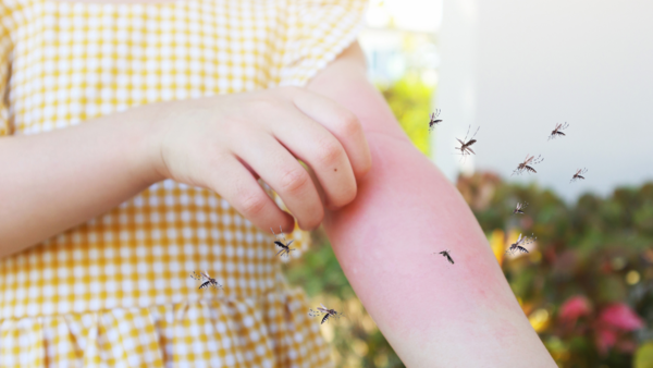 Symptoms of dengue fever and how to treat it at home