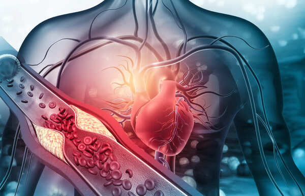 10-second pulse check that could reveal a hidden heart problem