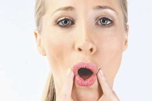 No more chubby cheeks