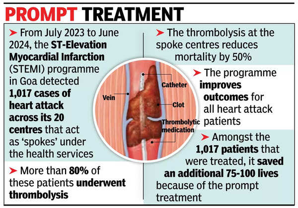 In Goa, average age of bypass surgery drops from 70s to 40s: Doc