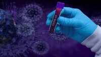 Delhi reports highest Covid-19 spike spike in nearly 2 months, active cases past 15,000 