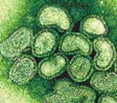 H1N1 Virus Changing '˜Colours'