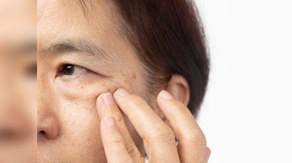Twitching eyelids