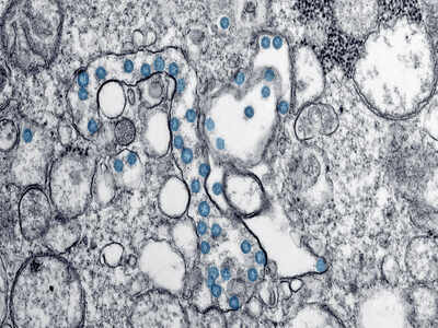 Shape of novel coronavirus’s crown