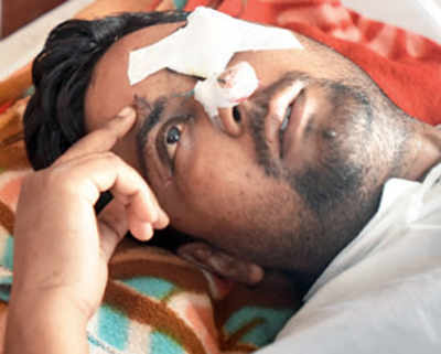 Bullet lodged in man’s eye socket removed via nose