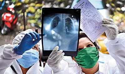 Mumbai: COVID virus hasn’t lost sting, doctors say looking at lung damage in young