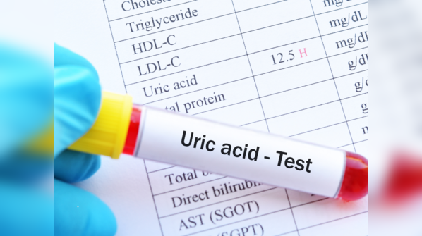 Natural remedies that help in reducing uric acid level in body