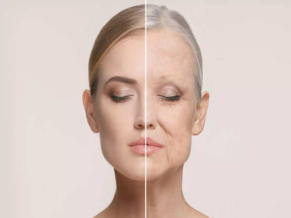 Don’t wait till you get wrinkles, start treating them beforehand