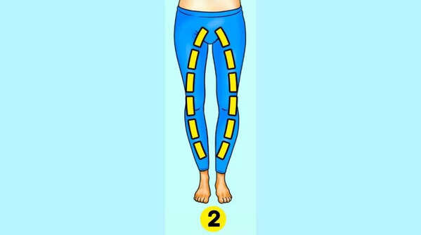 If you have bow-shaped legs, it means...